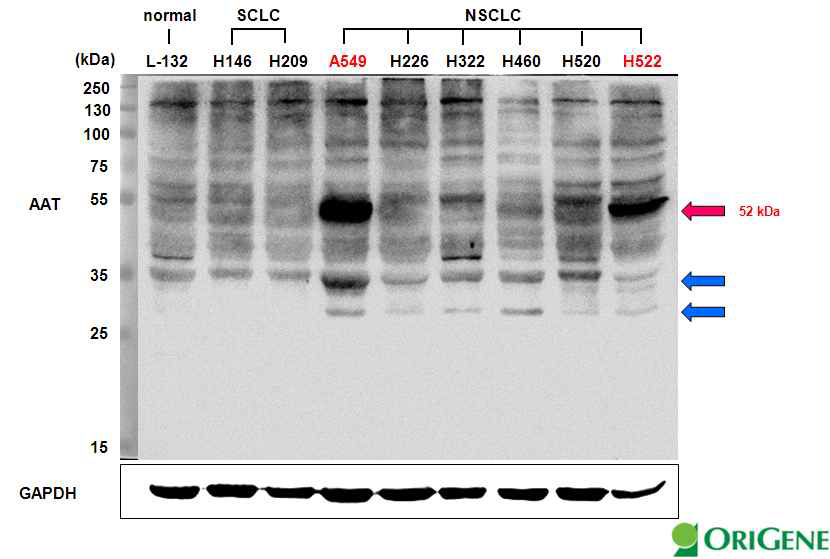 다양한 폐암세포주를 대상으로 alpha I-Antitrypsin (AAT)의 단백질 발현양 비교