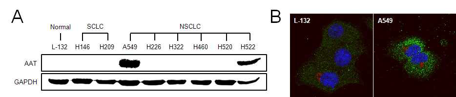 다양한 폐암세포주를 대상으로 AAT의 단백질 발현양 비교