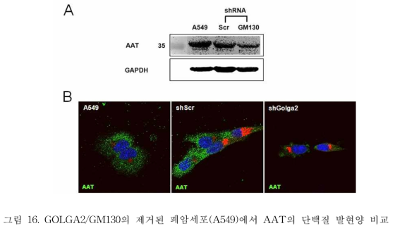 GOLGA2/GM130의 제거된 폐암세포(A549)에서 AAT의 단백질 발현양 비교