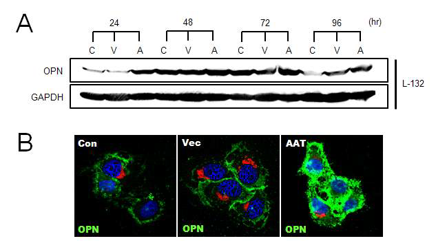 AAT 과발현 세포에서의 OPN 발현