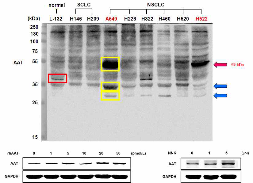 다양한 폐암세포주를 대상으로 alpha I-Antitrypsin (AAT)의 단백질 발현양 비교