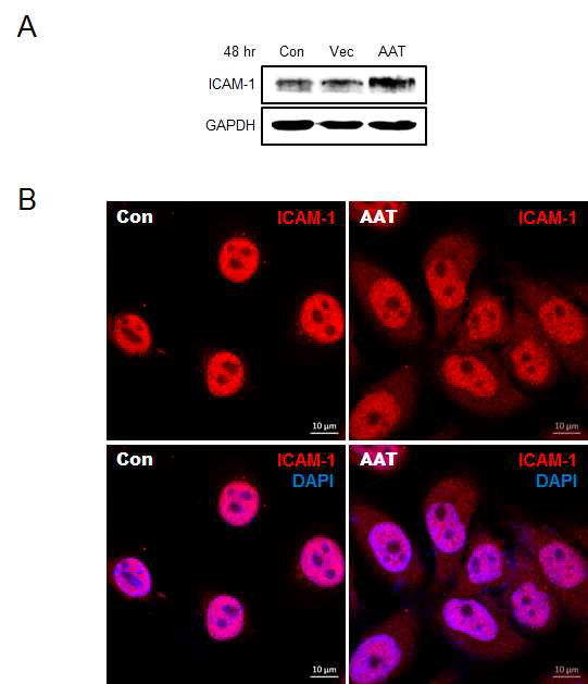 AAT의과발현이세포부착에미치는영향