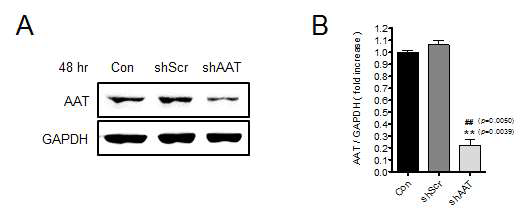 A549 세포에서 AAT발현억제확인
