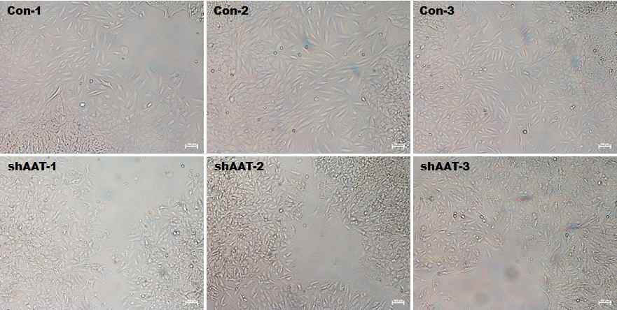 폐암세포에서 AAT의억제가세포증식에미치는영향