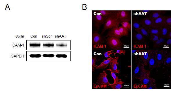AAT의과발현이세포부착능에미치는영향