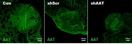 폐암모델마우스의 폐종양에서 AAT발현억제확인