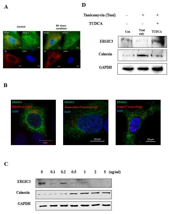 ERGIC3의 세포내 위치 및 소포체 스트레스에서의 발현