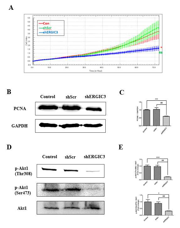 폐암세포에서 ERGIC3의 발현 억제가 세포 성장에 미치는 영향