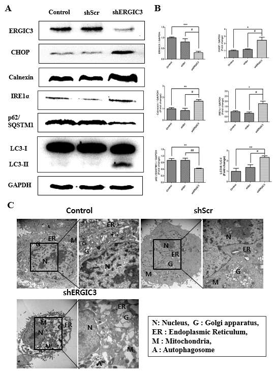 폐암세포에서 ERGIC3의 발현 억제가 소포체 스트레스 및 자가포식에 미치는 영향