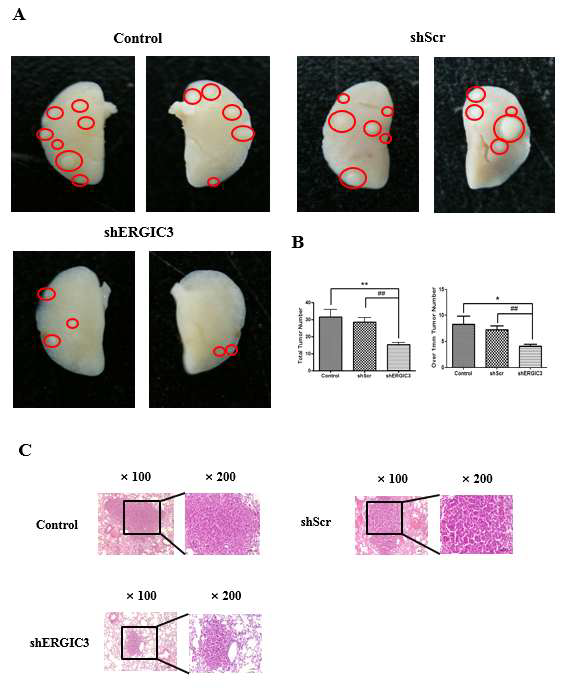 ERGIC3의 억제가 마우스의 폐암형성에 미치는 영향