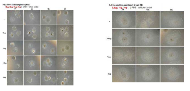 GRO 및 IL-8의 중화항체를 넣어 조건화배지의 시토카인 억제 결과.