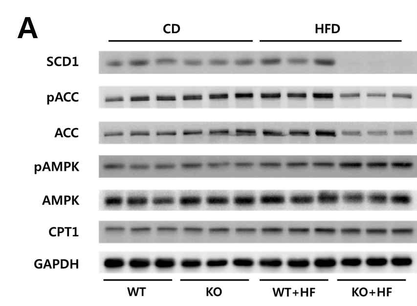 AHNAK KO 마우스의 간에서 지방대사와 관련된 mRNA의 발현이 조절됨.