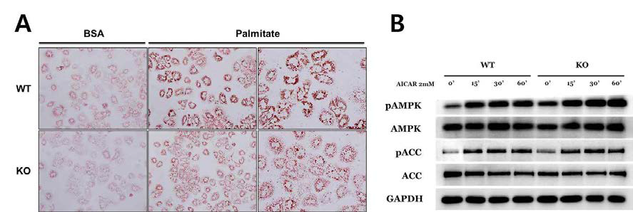 AHNAK KO 마우스의 간에서 AMPK pathway과 활성화 됨.