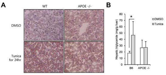 VLDL의 구성원 중 APOE가 결핍된 생쥐에 ER stress 유도시 지방이 증가되지 않음