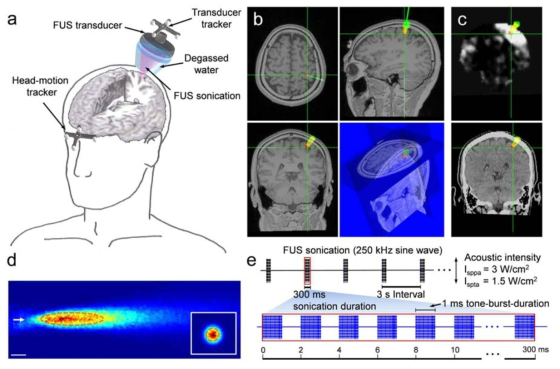 기능자기공명영상 (fMRI) 을 이용하여 사용자에 맞는 개개인의 고해상도 뇌 기능지도를 준비하고, 이 뇌지도상에서 집중초음파(d)를 공여할 지역을 조준할 수 있도록 하는 registration 기술의 개요도 (a,b,c) 및 뉴로모듈레이션을 유발하는 펄스화된 집중초음 파의 신호 도식(e).