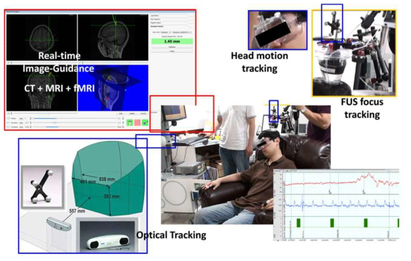 사용자의 움직임과 동기화된 멀티모달 이미지 영상에 기반한 집중초음파 자 극의 실제 실험 사진.
