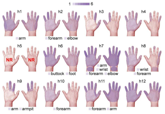 집중초음파 자극에 의해 유발된 감각의 위치를 손바닥쪽(左) 및 손등쪽 (右) 에 매핑하여 표시한 결과.