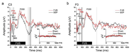집중초음파로 primary somatosensory cortex, S1영역을 자극하면서 (그래프 상의 검은 FUS막대 300ms 기간 동안) 에 표준 뇌파측정위치(10-20 EEG montage) C3 및 P3에서 측정된 FUS-mediated evoked potential 뇌파 (EEG)의 결과 (빨간색 그래프, FUS).