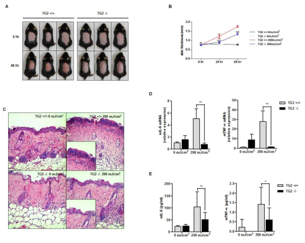 TG2 결핍쥐에서 자외선 조사에 의한 피부염증 연구.