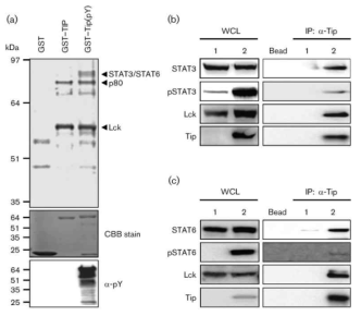 Tip 과 STAT6 결합.
