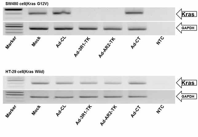 Observation of Kras gene level by RT-PCR in Ad-ribozymes infecting cells.