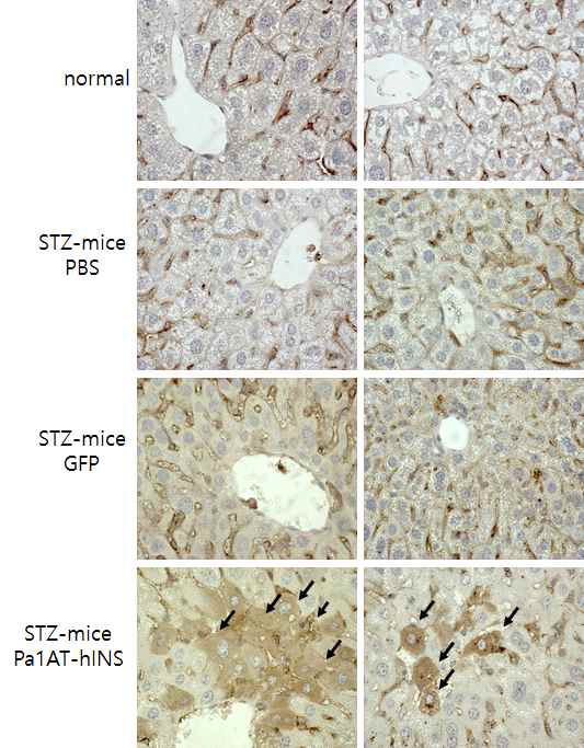 Human Insulin IHC of Liver in the Lentivirus-injected STZ-diabete mice