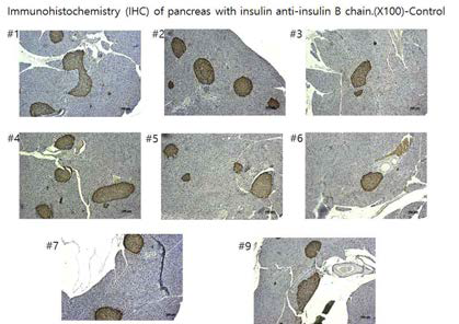 대조군 마우스 췌장의 인슐린 면역염색