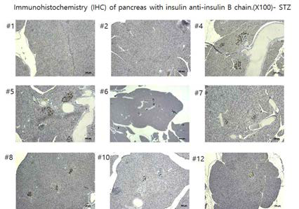 STZ 처리 마우스 췌장의 인슐린 면역염색