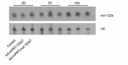 miR-122a level in normal mice infected with adenovirus