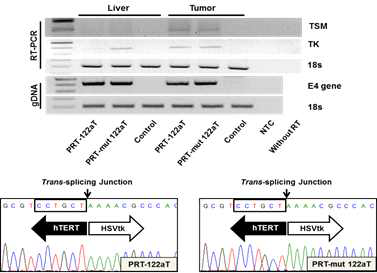 Analysis of TSM and TK expression in liver and cancer in xenografted mice infected with adenovirus