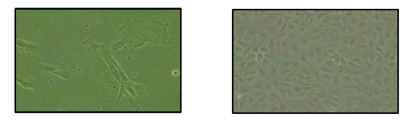 비강 상피 세포 (좌)와 폐암 상 피조직 세포 (우)의 배양 사진
