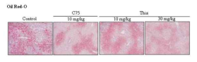 Thiacremonone 처리한 C57BL/KsJ db/db mice 지방간의 조직염색.