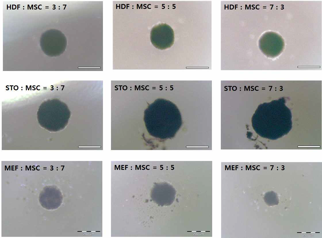 중간엽줄기세포와 피부유래 세포들을 각기 다른 비율로 섞어 assembly를 형성한 광학현미경 사진