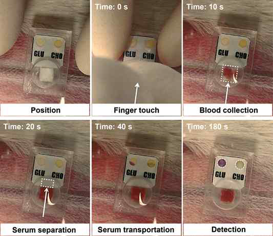 원터치 혈액 분석시스템을 이용하여 토끼의 혈액 채취 및 분석 실험 결과
