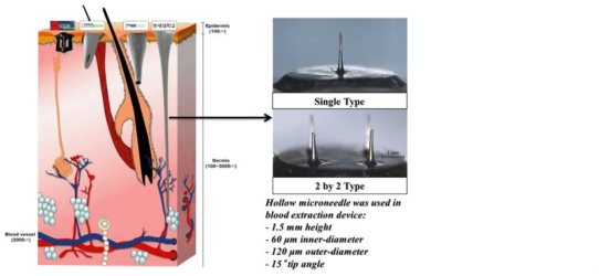 Single type 와 2 by 2 tpye 의 최소침습 혈액 채취용 중공형 마이크로니들.