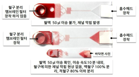 흡수패드 및 혈구분리 멤브레인 필터 장착 마이크로플루이딕 시스템 내 혈구 분리 및 혈액 이동 점검.