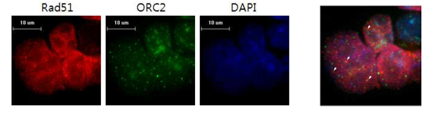 세포내의 DNA 복제개시 시점과 Rad51-DNA 복합체의 위치 및 거리 관찰.