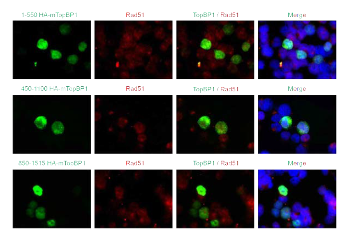 다양한 BRCT domain을 가지는 mouse TopBP1 의 세포 내 단백질 발현 패턴 분 석 결과.