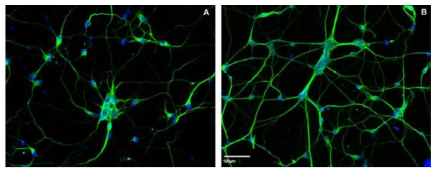 실리콘 표면에 Laminin-PEG, L1-PEG를 결합시킨 후 β-tubulin Ⅲ 염색을 통한 신경세포의 증식 효능 비교