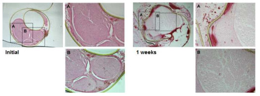 The histology analysis of nerve tissue after implant with cuff electrode using H&E staining