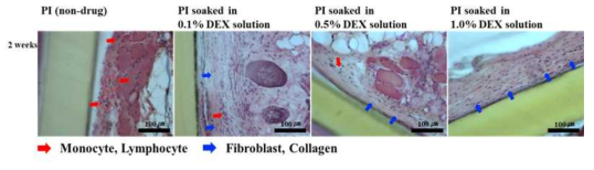 The histology analysis of skin-tissue after treatment with drug loaded PI film using H&E staining