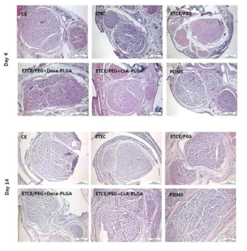 Rat의 sciatic nerve에 각 각의 cuff electrode를 이식한 후 4일과 14일에 신경 조직을 채취하여 생체내 비특이 반응 억제 평가 연구.