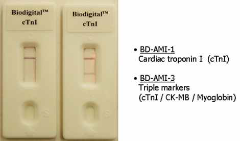 BiodigitalTM cTnI: 급성 심근 경색 진단용 정성키트 (Troponin I 정성 분석)