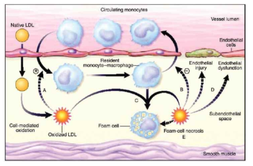 Oxidative modification 동맥경화증 가설