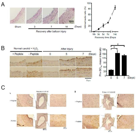 혈관 재협착 rodent 모델 및 동맥경화 환자 조직의 리모델링 과정 및 Prx-SO2/3 발현 확인