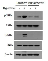 급성 페손상시 Duox2 mutant 마우스에서의 ERK 및 JNK의 인산화 분석