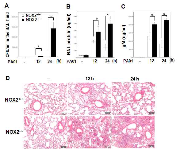 PAO1에 의한 급성 폐감염 마우스모델에서 NOX2 ko 마우스와 wt 마우스에서 폐손 상 및 염증반응