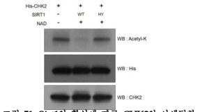 Sirt1의 활성에 따른 CHK2의 아세틸화