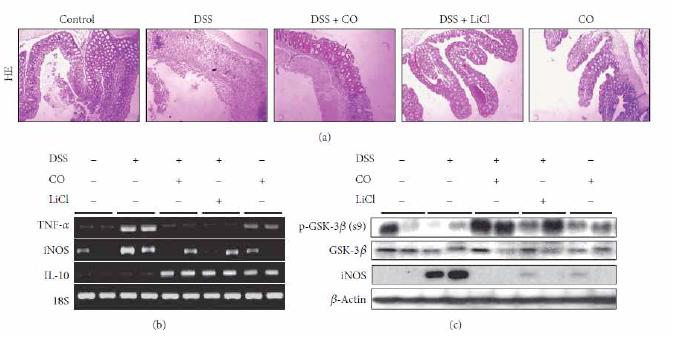 COattenuates experimental colitis asmeasuredbyhistology incolonand inflammatory cytokines in colon