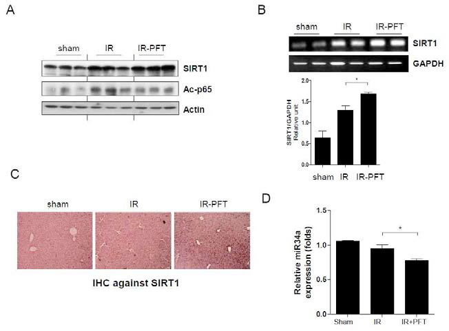 PFT induces SIRT1 expression after hepatic ischemia/reperfusion (I/R)